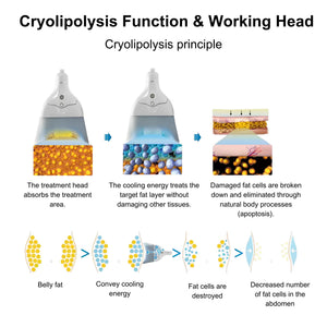 Cryolipolysis-Fat-Freezing-Machine-Zen_2