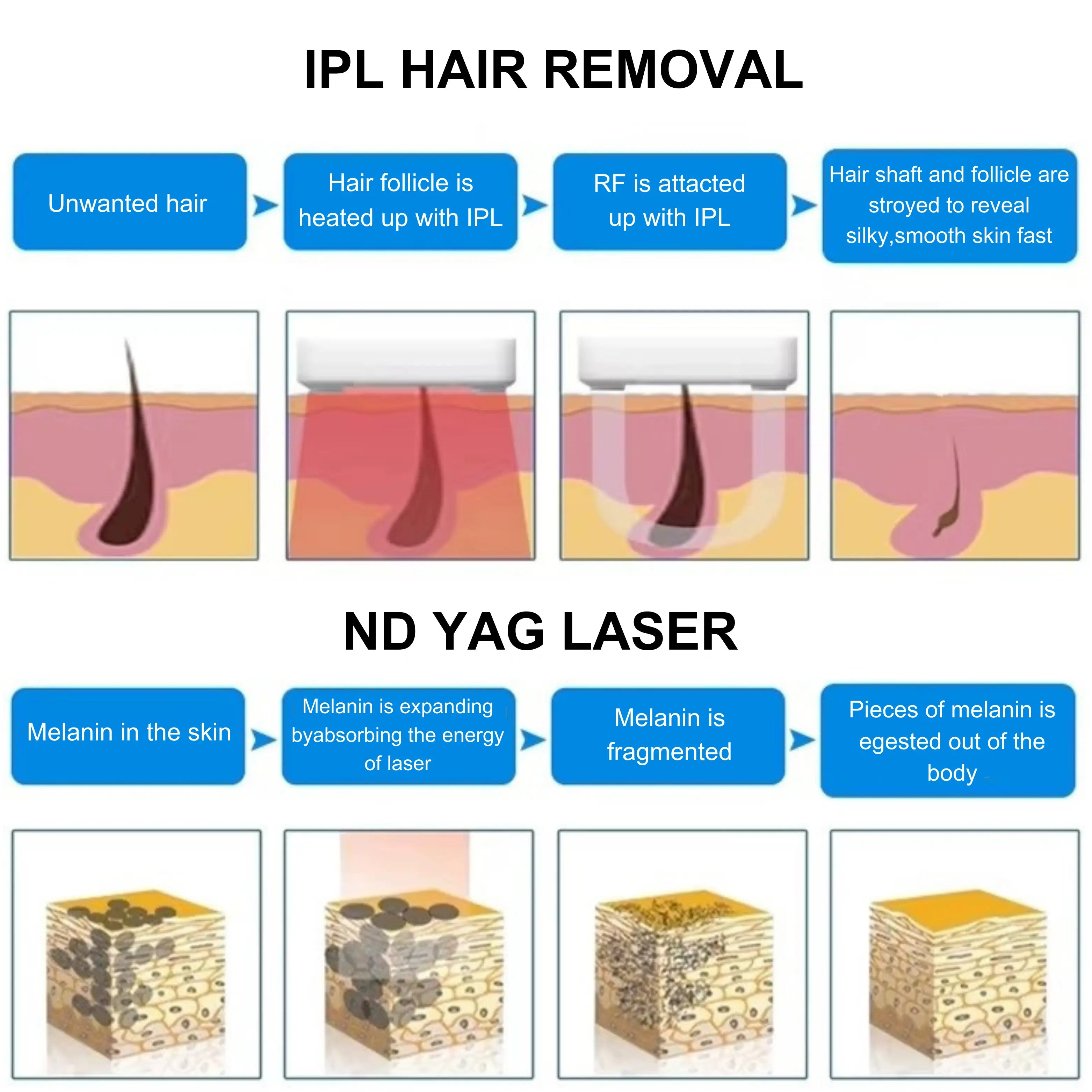 3-in-1-Laser-Machine-for-Hair-Removal_Tattoo_Removal_E-Light-Skin-Rejuvenation_3