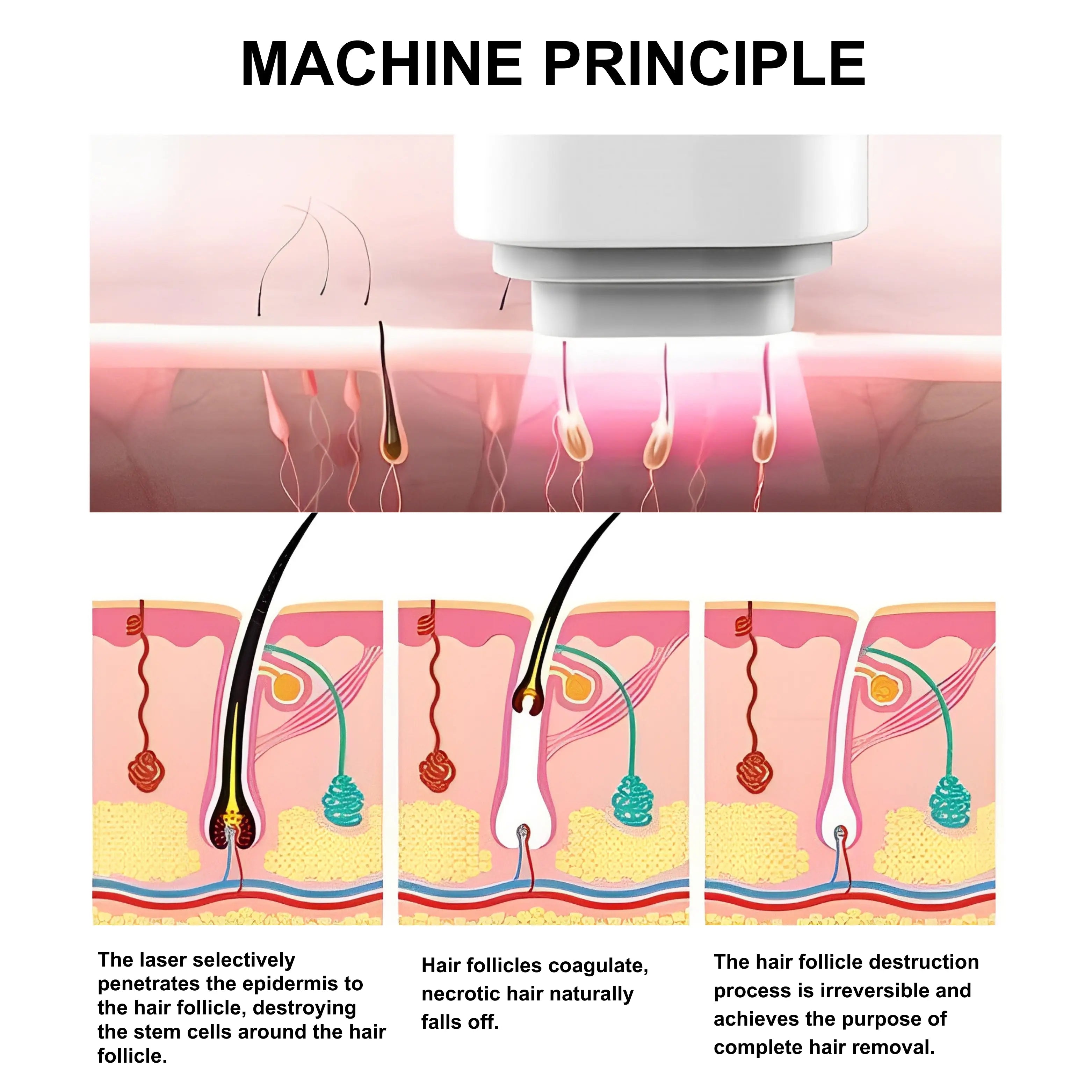 808 nm-Diode-Laser-For-Hair-Removal-LitePro-2