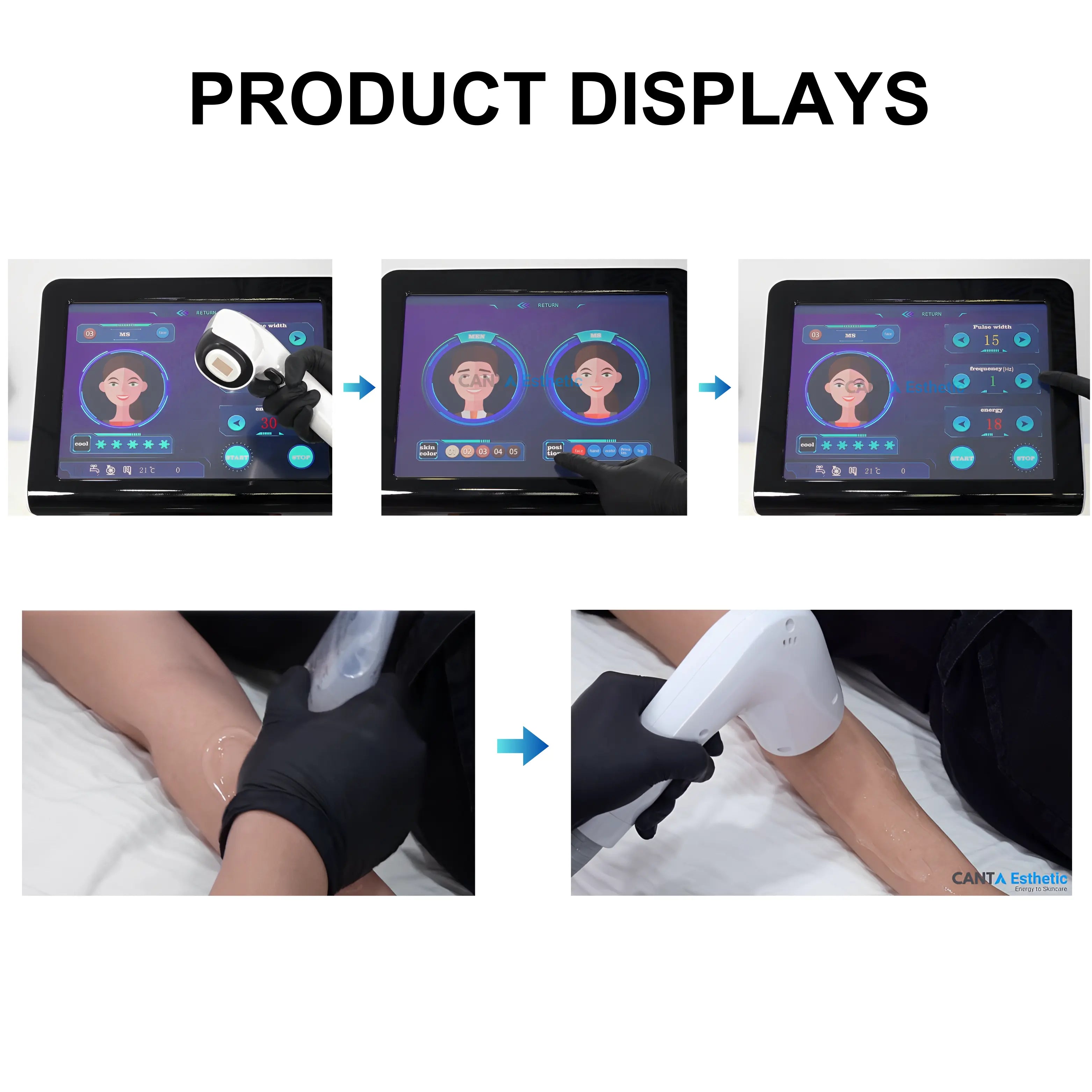 808-nm-Diode-Laser-For-Hair-Removal-LitePro_5