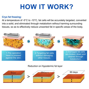Cryotherapy-Mahine-with-Cryo-Boards_2