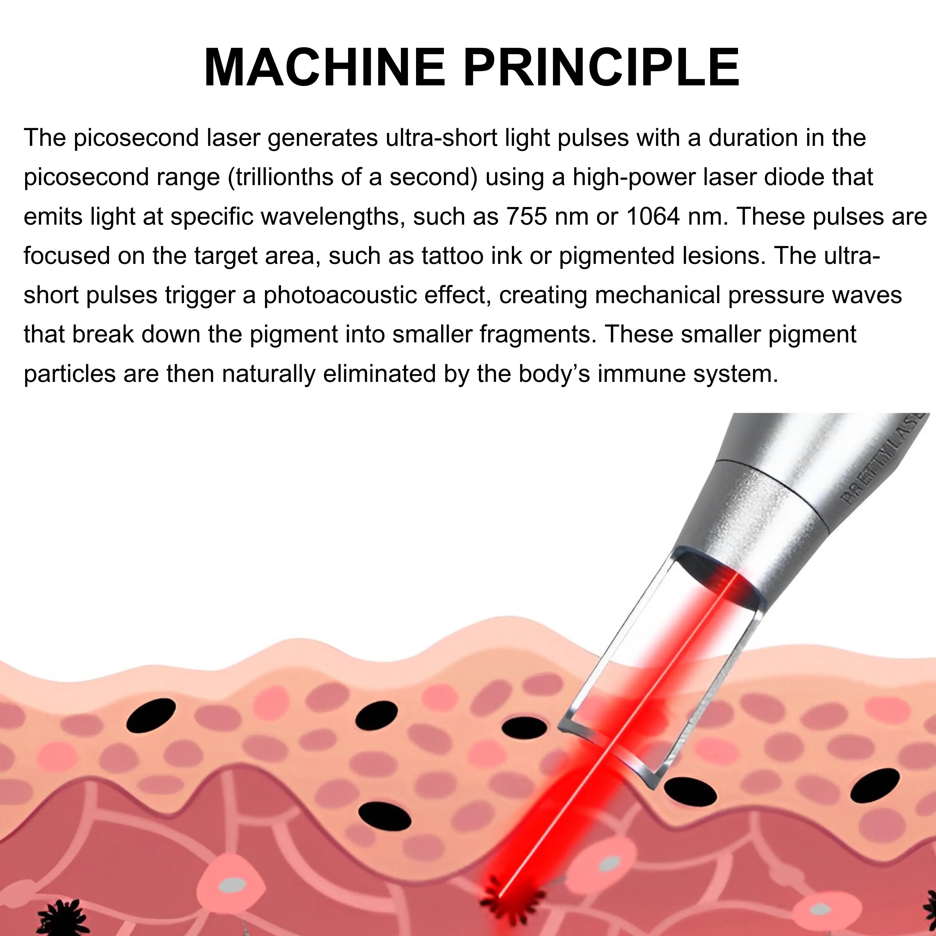 Laser-Tattoo-Removal-Machine-PicoLITE_2