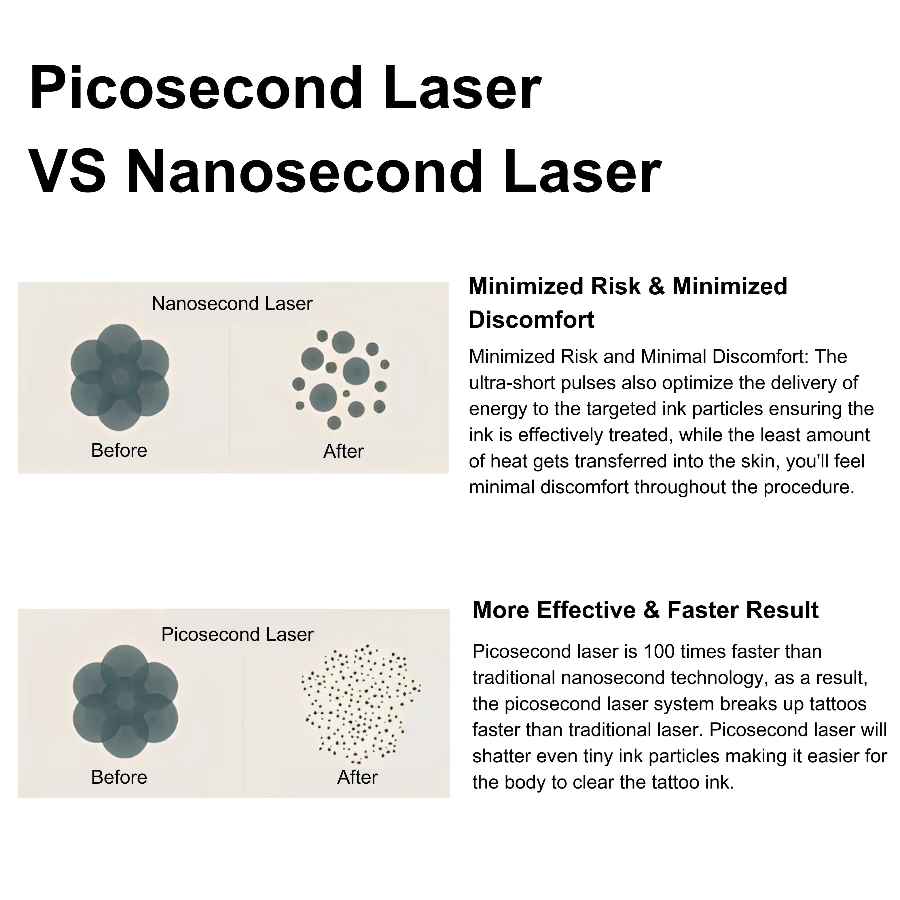 Laser-Tattoo-Removal-Machine-PicoLITE_3